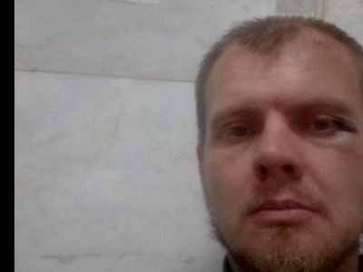 Избитый Алексей Барабошкин. Фото: https://twitter.com/teamnavalny_che Избитый Алексей Барабошкин. Фото: https://twitter.com/teamnavalny_che